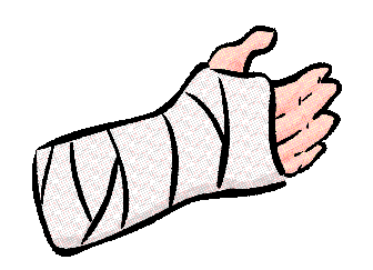 clipart arm cast
