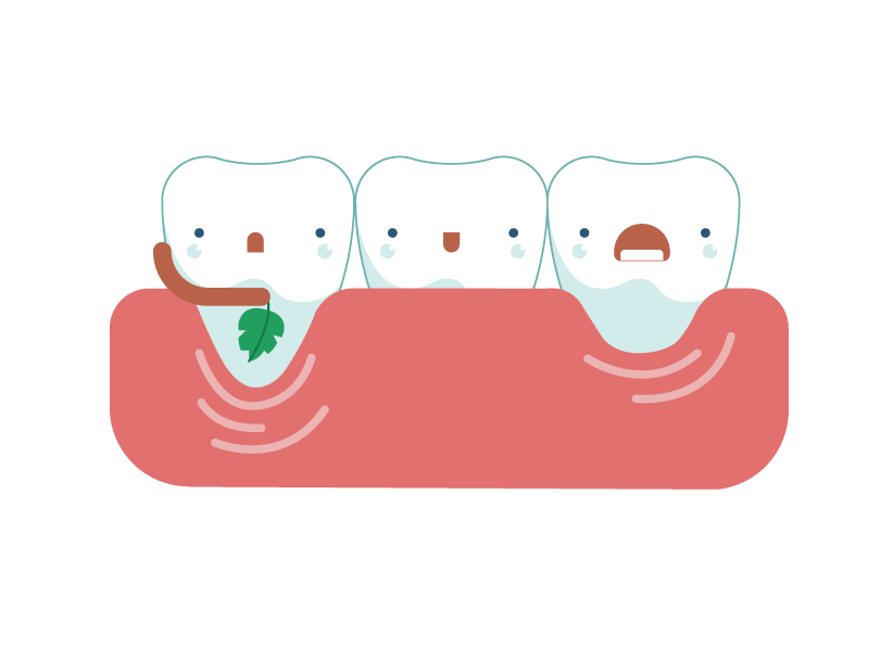 Gum clipart tooth gum, Gum tooth gum Transparent FREE for