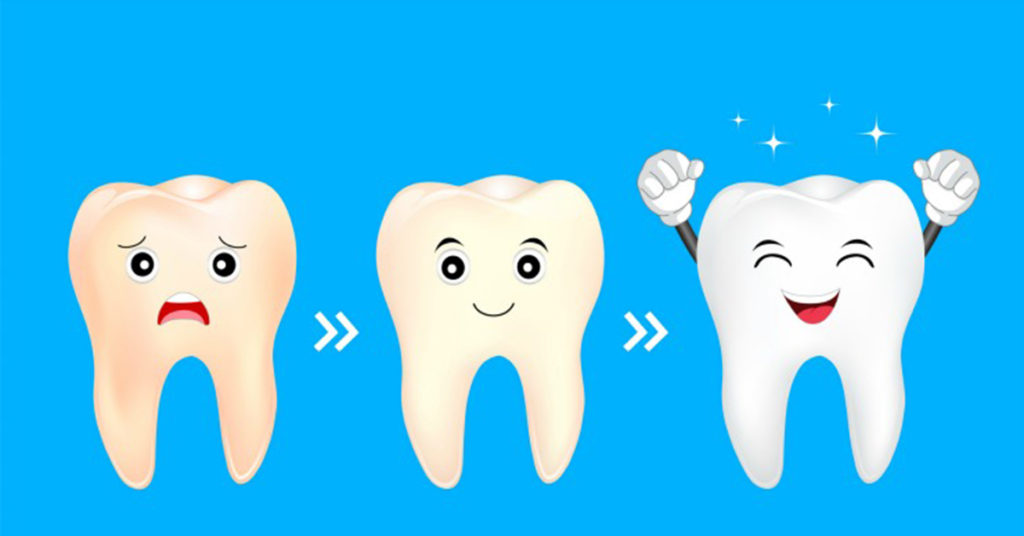 toothache clipart decayed tooth decay