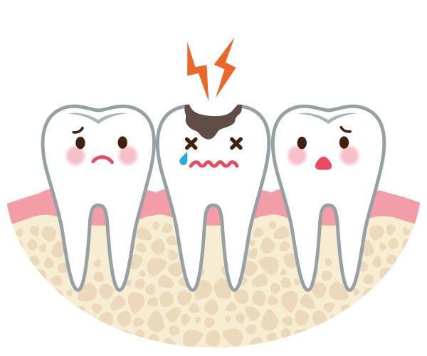 How alleviate tooth.