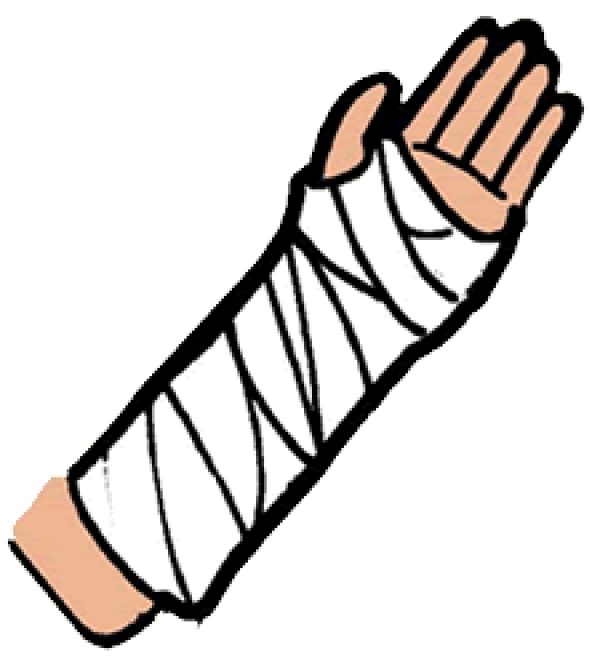 Clipart Arm Cast and other clipart images on Cliparts pub™