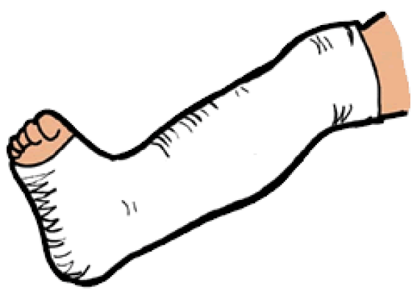 Clipart Arm Cast and other clipart images on Cliparts pub™